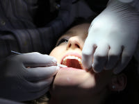 La maladie parodontale : Centre dentaire Saint Just Marseille 13