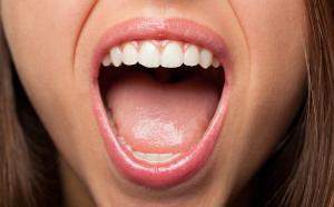 brulure bouche syndrome dentiste marseille