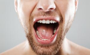 symptomes syndrome bouche brulante dentiste marseille